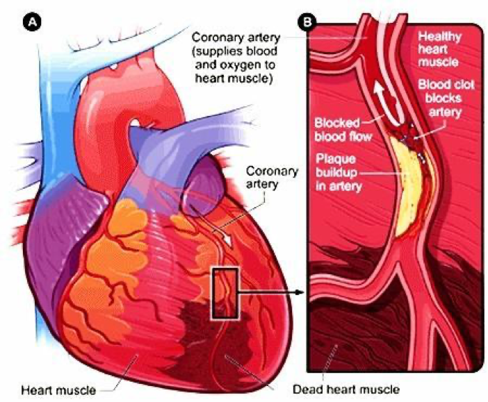 Advanced Cardiovascular Care